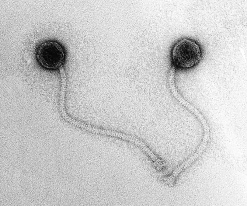 Siphovirus Picture